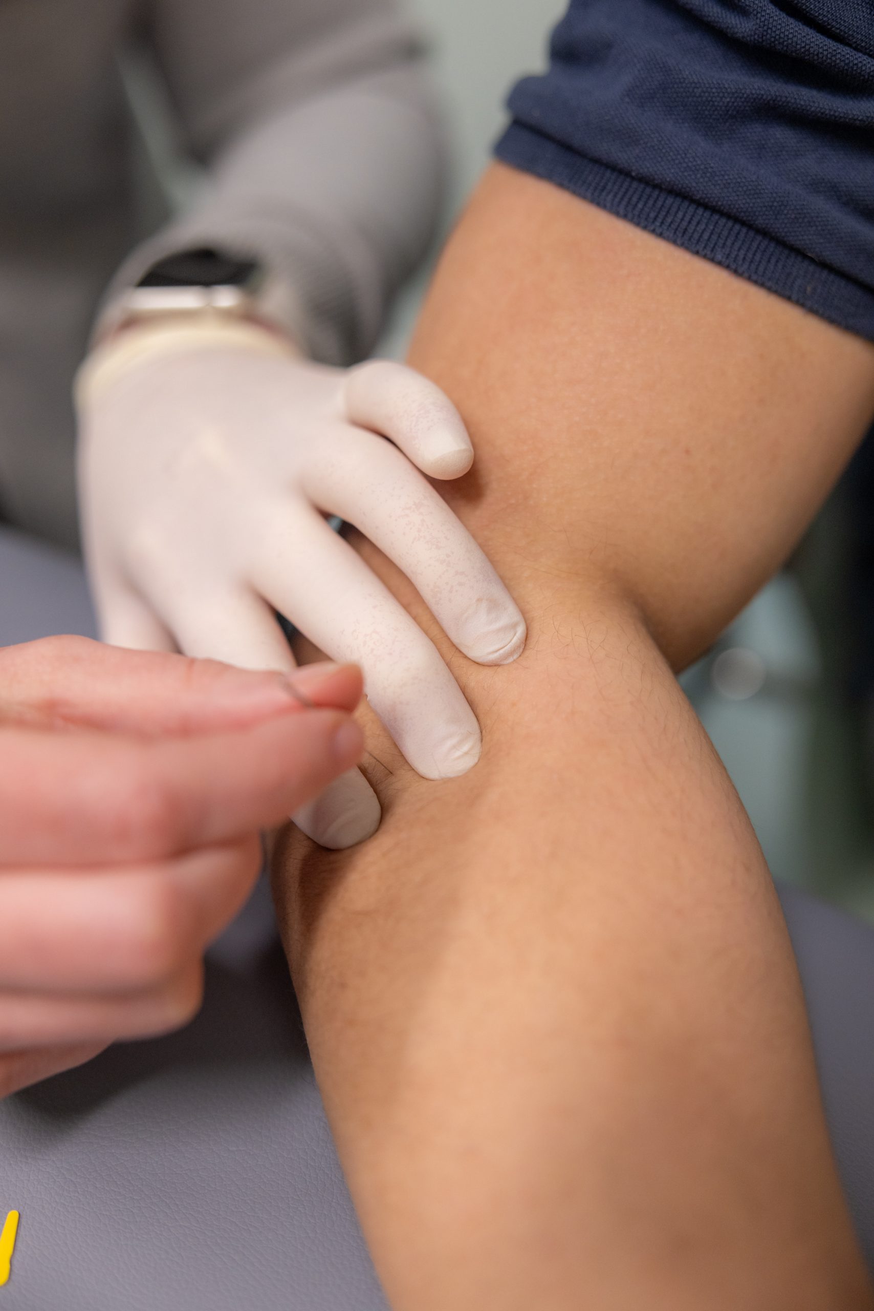 Dry_Needling_3_Fysio_Fitplan_Vianen